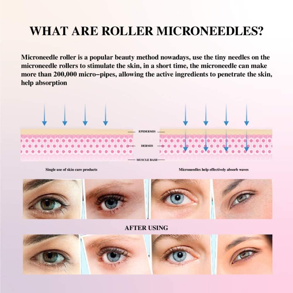 Derma Roller Anti Ageing Regeneration Massageroller Mikronadelrolle Mesotherapie